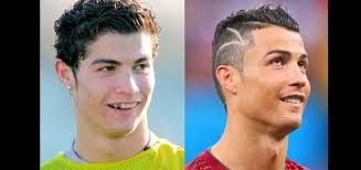 Portuguese footballer cristiano ronaldo plays forward for real madrid. Cristiano Ronaldo Avant Chirurgie Steven Bernier