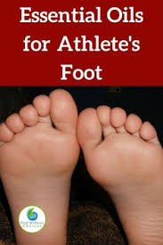 Proven to cure most athlete's foot: 110 Feet Ideas In 2021 Foot Remedies Stinky Feet Feet Care