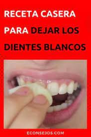 Pin En Remedios