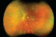 Optomap Imaging — Expert Eye Care, Arthur Hayes Opticians