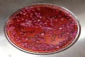 bacterial colony on macconkey agar