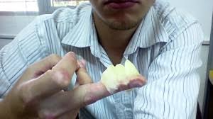 Maybe you would like to learn more about one of these? I Use Vaseline For Psoriasis Wherever I Go
