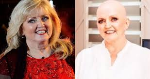 Linda nolan, who found fame with her siblings as pop group the nolans in the late 1970s, has responded to a complaint on twitter, days after completing her cancer treatment. Linda Nolan Confirms Her Liver Cancer Has Spread The Irish Post