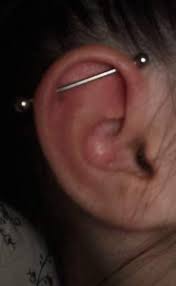 industrial piercing nach 3 monaten auf einmal angeschwollen gesundheit und medizin schwellung