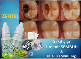 Obat sakit gigi dan gusi bengkak paling ampuh. Obat Sakit Gigi Dan Gusi Bengkak Paling Ampuh Obat Gigi Berlubang Ngilu Dan Bau Sakit Di Depan Ampuh Zentri Obat Sakit Gigi Berlubang Paling Ampuh Original 100 Lazada Indonesia