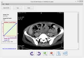 Various tools are available which are arranged in a very clean manner on the interface. Download Free Dicom Viewer 1 For Windows Filehippo Com