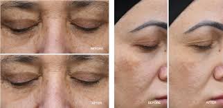 Facial Sculpting Wand Plus Peptide Treatment Refill