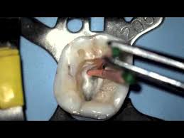 Resultado de imagen para preclinico odontologia