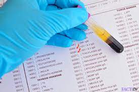 The results of the tests for igg, iga, and igm levels are usually evaluated together. Herpes Simplex Virus Hsv Igm Test Results Risks Factdr
