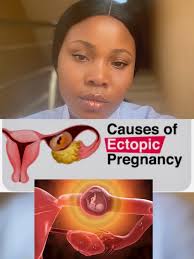 Never posted before and it's probably nothing but I can't help but wonder  ❤️ so here goes... a good while ago I had issues getting pregnant,  previously already had one child. So