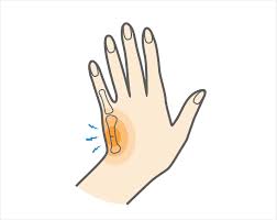 Symptoms include pain and a depressed knuckle. Boxer S Fracture Upswing Health