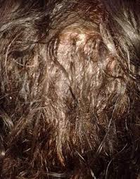 Rinse as usual, then use a comb to loosen the glue bond. Ajf Hair Glued To Scalp Nalan Com Sg