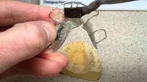 Retainer Repair Youtube