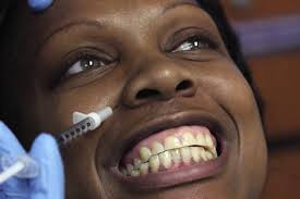 Botox and Dermal Fillers