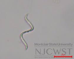 Image result for Raphidiocystis