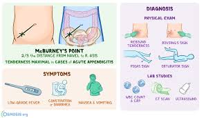 Image result for Pediatric Appendicitis Lab Score