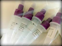 Date, history, significance and all you need to know about the special day friendship day 2021 date in india: Inzidenzen In Der Sudpfalz Am 1 August 2021 Pfalz Express