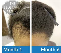 Therefore, it typically takes more of a. Women With Afro Hair Ditch Damaging Weaves And Chemical Treatments