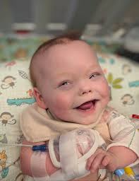 It's easy to forget how far she has come. It's amazing to me. I look back  and wonder how we didn't completely break looking at her. At the time, we  were just