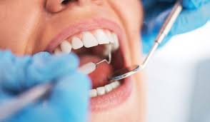 Tout Savoir Sur Les Couronnes Dentaires Doctissimo