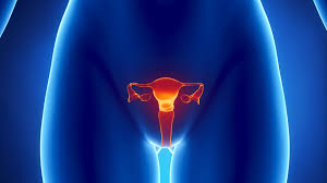 The bleeding may occur between menstrual periods or after sex. Can Cervical Stenosis Cause Infertility
