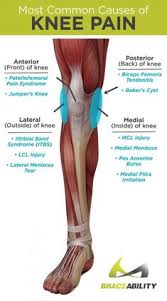 How do you unlock a locked knee.how do you unlock your knee? Knee Replacement Info