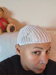 Glioblastoma treatment options and personal experiences