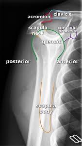 Image result for Shoulder XRay