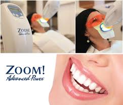 Philips zoom whitening gives you the confidence to do what you do best, shine. Zoom Teeth Whitening In Holland Mi Gordon Prince Family Dentistry