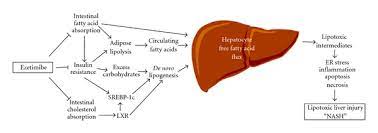 Potential Therapeutic Effects Of Ezetimibe On Nonalcoholic Fatty Liver Download Scientific Diagram