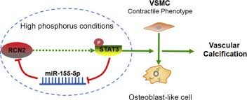 doc diagram smooth tissue diagram ebook | schematic. Osteogenic Differentiation And Calcification Of Human Aortic Smooth Muscle Cells Is Induced By The Rcn2 Stat3 Mir 155 5p Feedback Loop Sciencedirect