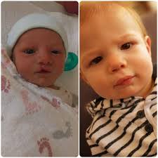 Step into the heart of Cleft Hospital Gujrat and relive the inspiring  moments from the International Cleft Surgeons Team Visit