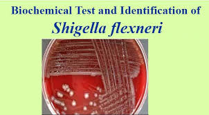 Image result for Shigella
