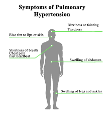 Image result for Pulmonary Intoxicant