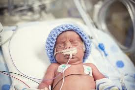 Evidence of meconium (dark green streaks) in the amniotic fluid and on the baby's skin. Meconium Boston Law Group Llc