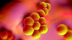 Image result for Staphylococcus Aureus