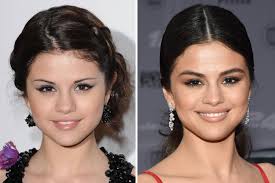 The base of her nose seems flatter. Celebs Then And Now Selena Gomez Gigi Hadid And More Teen Vogue