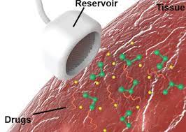 3d diagram of the liver. 3d Printed Implant Keeps Liver Patients Alive As They Hold Out For Donors 3d Printing Industry
