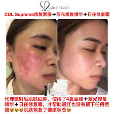 Madame julie roubère attendait sa sœur aînée, mme henriette létoré, qui revenait d'un voyage en suisse. Buy Clair De Lune Supreme Repairing Mask 5 Pieces Box Online Eromman