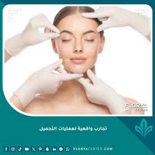 تجارب واقعية لعمليات التجميل: 5 قصص ملهمة ومؤثرة جداً
