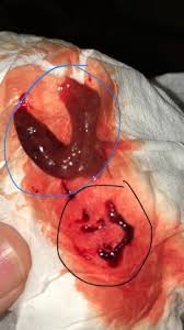 Check spelling or type a new query. Is This A Miscarriage Graphic Picture