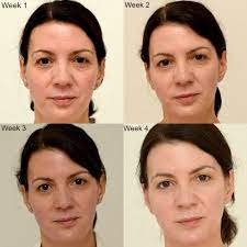 Les compléments alimentaires belle peau ne cessent de remplir les linéaires des pharmacies et des para pharmacies. Le Meilleur Soin Pour Avoir Une Belle Peau L Alimentation Cola S Hood