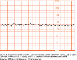 Intrapartum Assessment Williams Obstetrics 25e