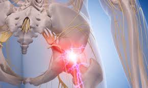 There is no pain walking or i have severe calf pain after sitting for an extended period of time. Sciatica And Sciatic Nerve Pain Information