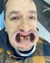 sadam younes (@drsadamyounes) • Instagram photos and videos