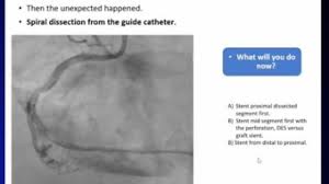Daher sollte sofort nach diagnosestellung mit einer antithrombotischen behandlung begonnen werden. Nstemi Non St Segment Elevation Myocardial Infarction