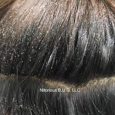 What do nits and lice look like? Does Your Client Have Lice This Is What To Do Behindthechair Com