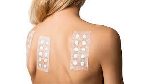 Image result for Patch Testing