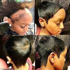 Hairstylist Warns About How Damaging Weaves Can Be Severe Hair Loss Short Natural Hair Styles Razor Chic Of Atlanta