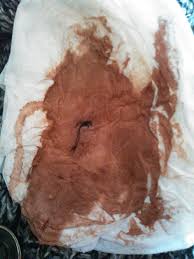 Image result for the prophecy name for REVELATION 12 the Holy Grail is Lapointe